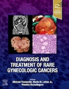 Diagnosis and Treatment of Rare Gynecologic Cancers | تشخیص و درمان سرطان های نادر زنانه